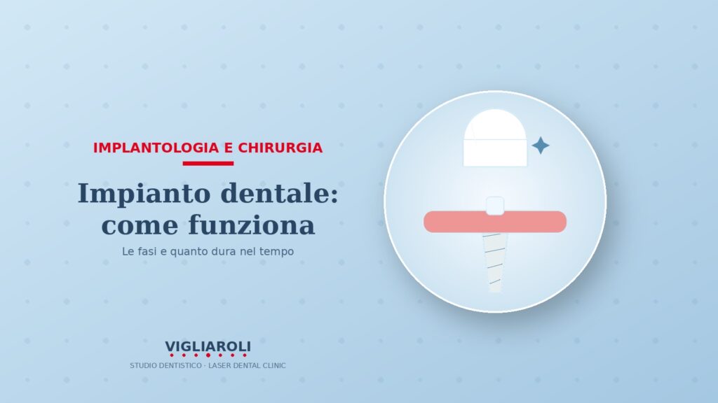 Impianto dentale: come funziona e quanto dura