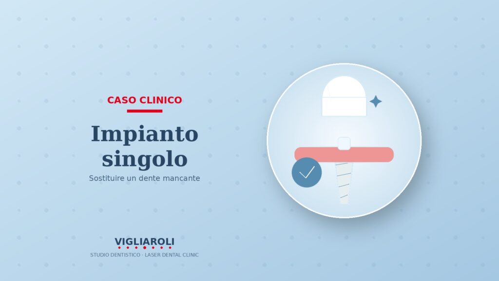 Sostituzione di un dente con impianto singolo: un caso reale